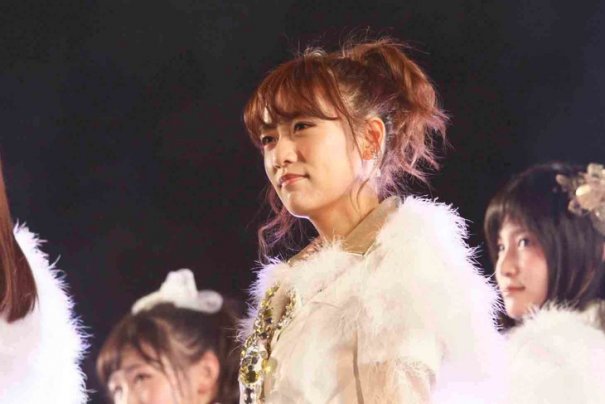 Minami Takahashi (AKB48) menderita penyakit tendinitis