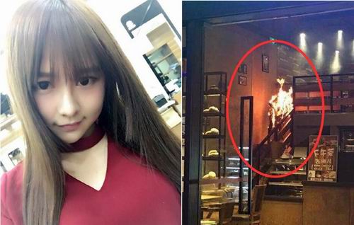Member SNH48 menderita luka parah akibat terbakar seluruh tubuhnya