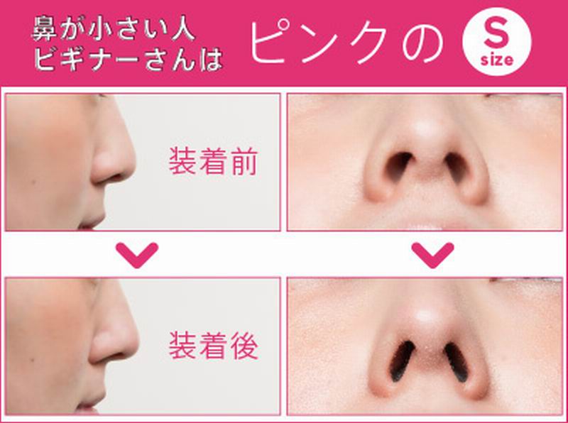 Produk Pemancung Hidung Dari Jepang Buat Hidung Jadi Lancip (3)